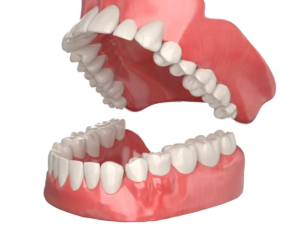 Modelo de dentadura articulada para enseñar cepillado
